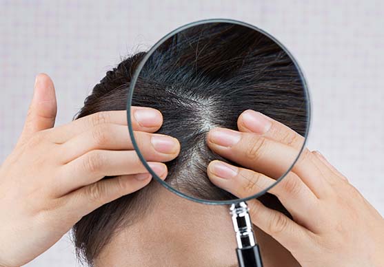 殺菌効果で炎症防止。敏感肌の方にもオススメ!